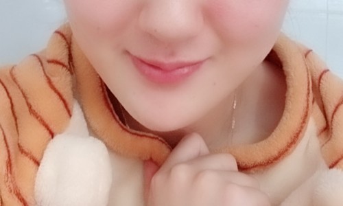 李方奇：注射的嘟嘟唇后肿胀，原来是奥美定