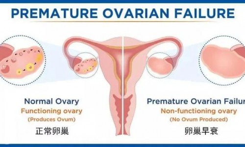 大连美琳达生殖内分泌吴隆琦医生带你了解 影响职场女性生活中的生殖内分泌