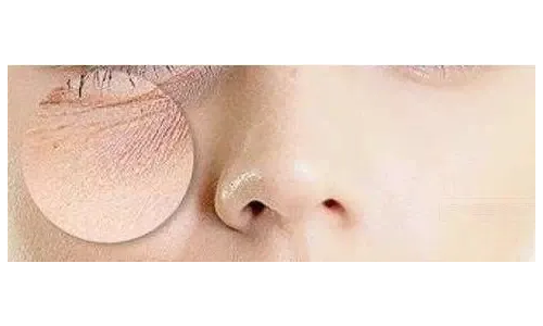 如果眼霜不能解决你的眼纹，试试专家推荐的克奥妮斯微针眼膜