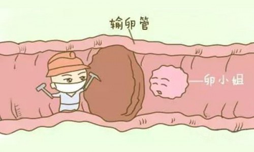 西安治疗输卵管堵塞哪家医院好？西安生殖保健院